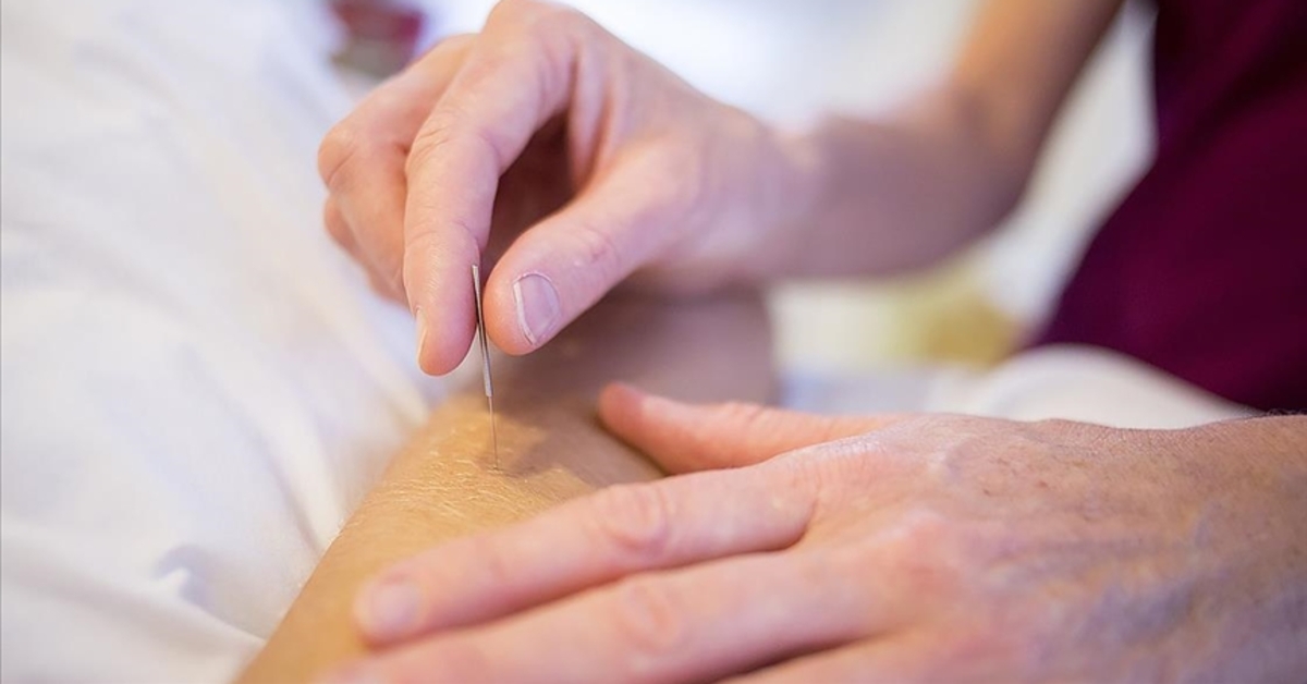 Akapunktur tedavisi gören siyatik hastalarının daha az ağrı çektiği belirlendi