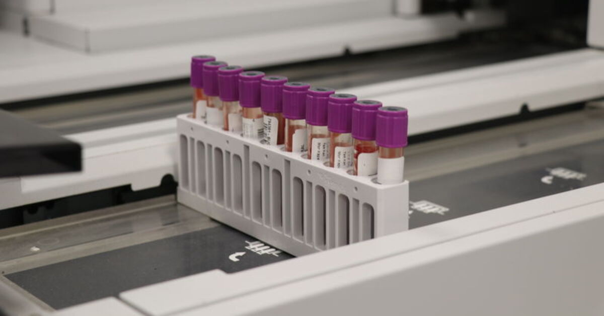 Mikrobiyota analizi meme kanserinin tanı ve tedavisine ışık tutacak